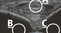 CAV_12_2010 Ultraschall Sonographie_03 (jpg)