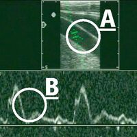 CAV_12_2010 Ultraschall Sonographie_04 (jpg)
