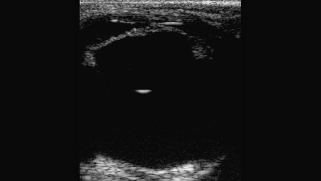 CAV_12_2010 Ultraschall Sonographie_07 (jpg)