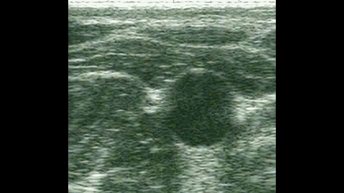 CAV_12_2010 Ultraschall Sonographie_08 (jpg)
