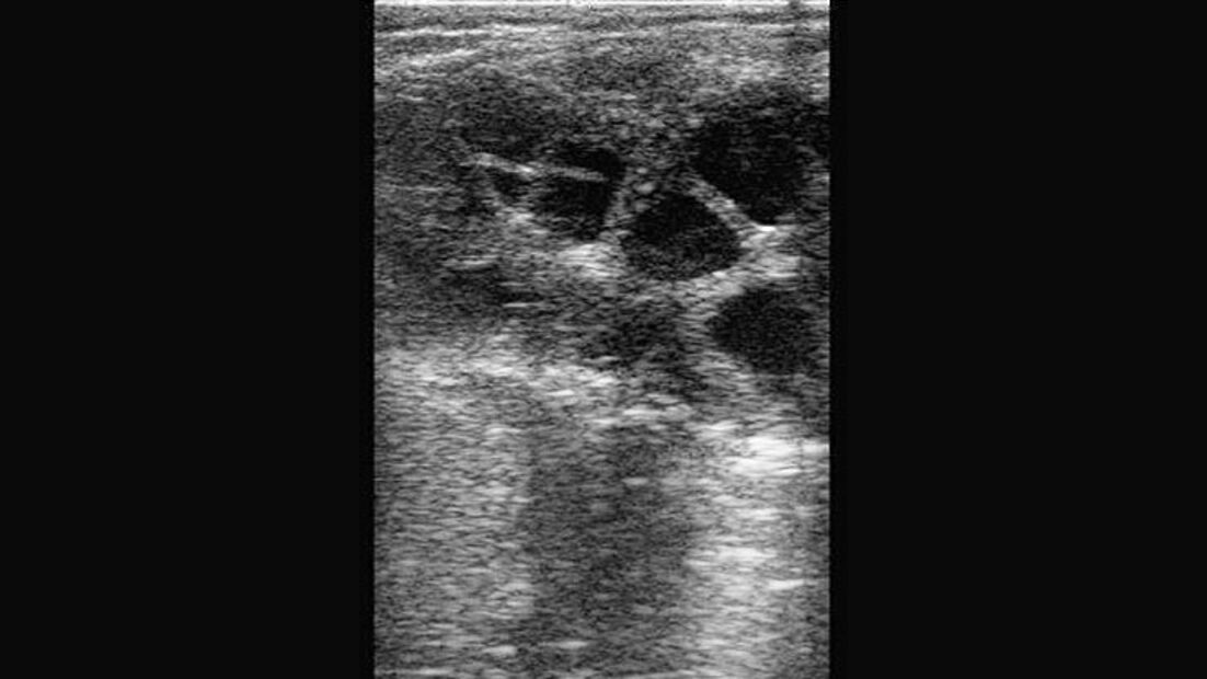 CAV_12_2010 Ultraschall Sonographie_09 (jpg)