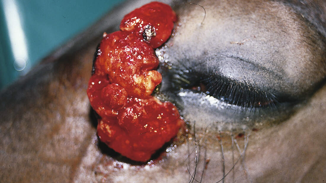 CAV Symptom-Lexikon - Equines Sarkoid