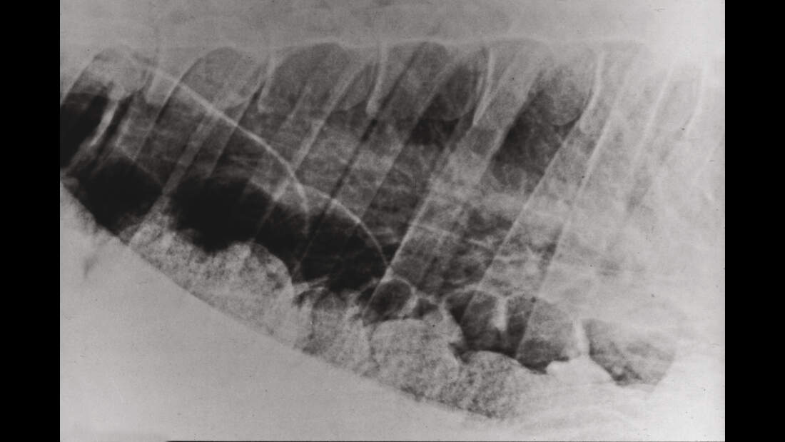 CAV Symptom-Lexikon Zwerchfellbruch