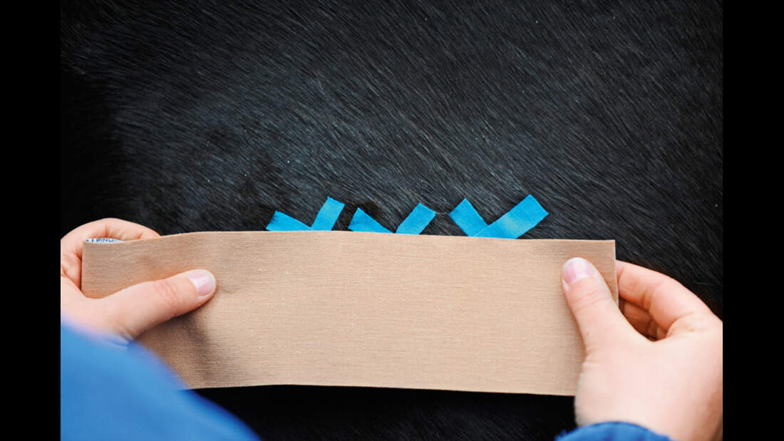 CAV Tape Kinesio Tape Medizin Muskeln 8